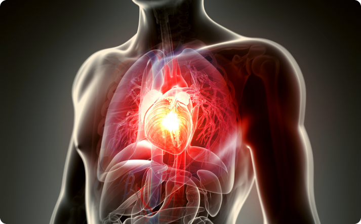 Angioplasty procedure in Singapore