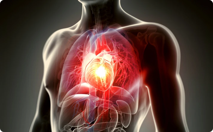 Angioplasty procedure in Singapore Angioplasty procedure in Singapore