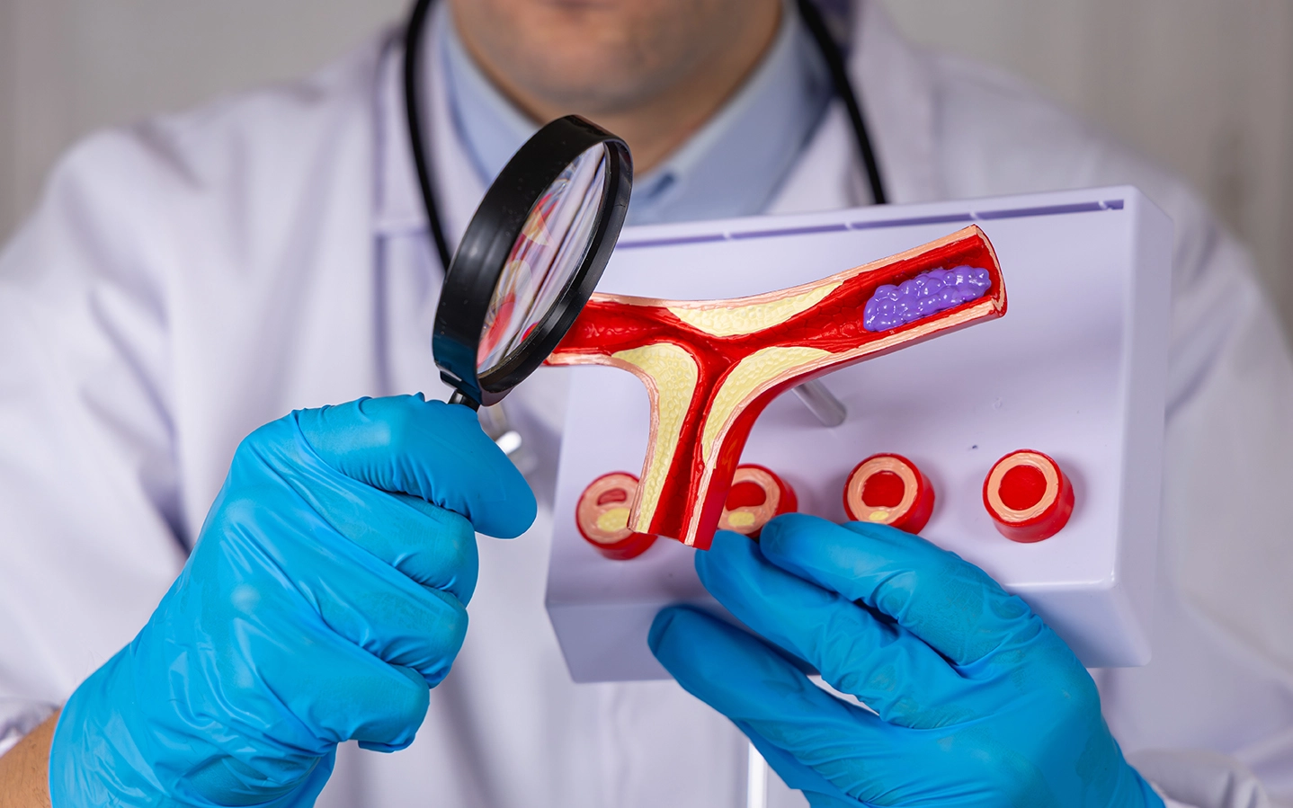 How Do Angioplasty and Bypass Surgery Treat Blocked Arteries?